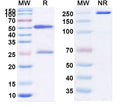 Anti-Human ST2/IL-33R Reference Antibody (Melrilimab) – Figure 1 of 1