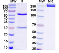 SDS-PAGE for Anti-Human RAD23B/HR23B Monoclonal Antibody (1A135)