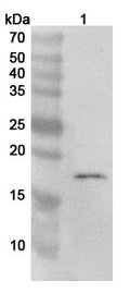 Western blot analysis was performed using anti-CDKN2D polyclonal antibody at 1ug/mL on various samples.
Lane 1: Jurkat cell lysate