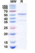 Recombinant Human PPP2R2A Protein, N-His