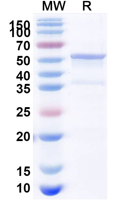 Recombinant Human PPP2R2A Protein, N-His