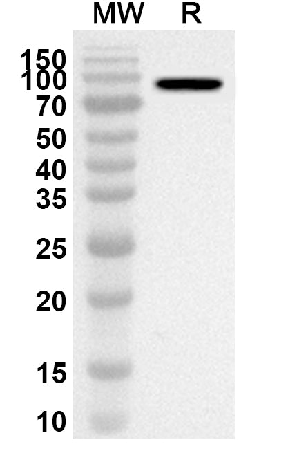 Western blot analysis was performed using anti-MDM2 polyclonal antibody at 1ug/mL on recombinant MDM2 (Catalog No. HX174012).