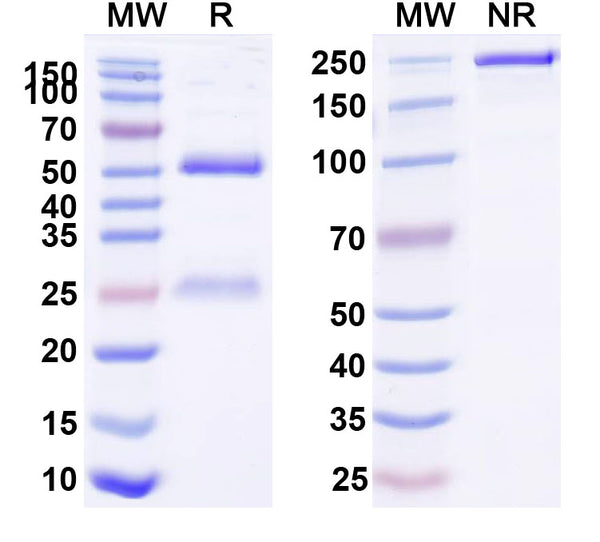 SDS-PAGE for Anti-Human CBX1 IP Antibody (SAA0195)