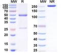 SDS-PAGE for Anti-Human CBX1 Antibody (SAA2129)
