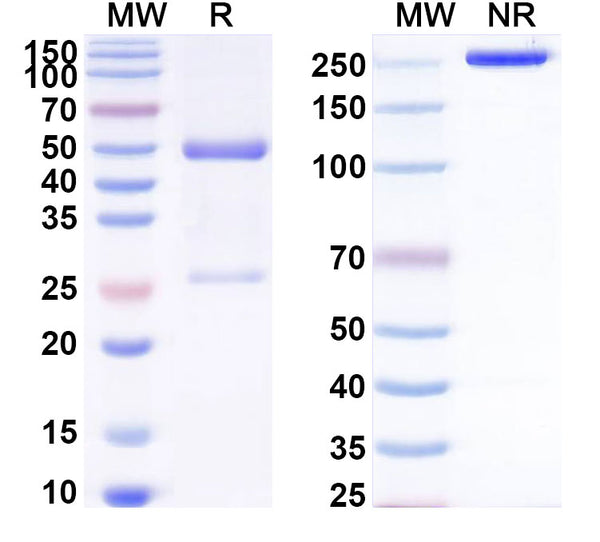 SDS-PAGE for Anti-Human CBX1 Antibody (SAA2129)