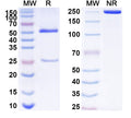 SDS-PAGE for Anti-Human AQP4/Aquaporin-4 Antibody (SAA1755).