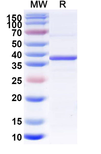 Recombinant Human WNT3A Protein, N-His