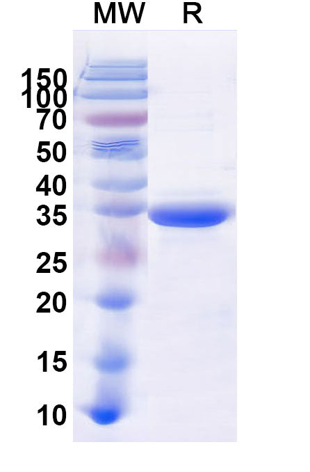Recombinant Human CD156b/ADAM17 Protein, N-His