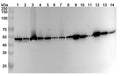 Western blot analysis was performed using anti-ACTR3 polyclonal antibody at 1ug/mL on various samples.
Lane 1: A549 cell lysate
Lane 2: A431 cell lysate
Lane 3: HL60 cell lysate
Lane 4: Hela cell lysate
Lane 5: Jurkat cell lysate
Lane 6: K562 cell lysate
Lane 7: PC-3 cell lysate
Lane 8: U2OS cell lysate
Lane 9: Mouse spleen lysate
Lane 10: Mouse lung lysate
Lane11: Mouse liver lysate
Lane12: Rat spleen lysate
Lane13: Rat lung lysate
Lane14: Rat liver lysate