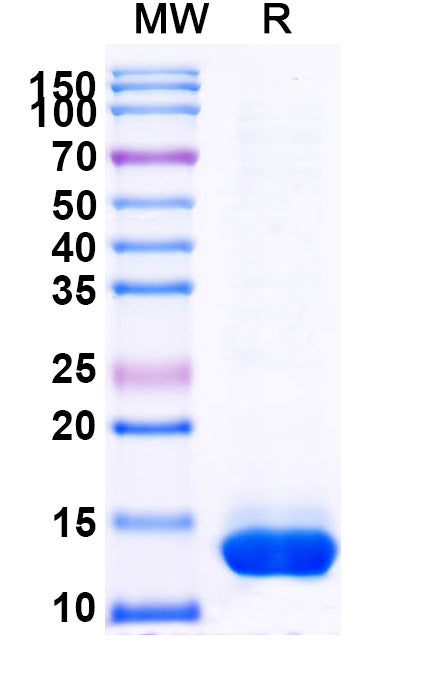 Recombinant Human BID Protein, N-His