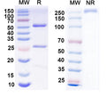 SDS-PAGE for Anti-DLX1 Antibody (L43/40)