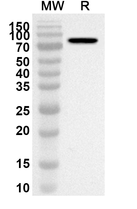 Western blot analysis was performed using anti-Human ADARB1 polyclonal antibody at 1ug/mL on recombinant Human ADARB1 (Catalog No. HX225012).