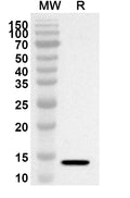 Western blot analysis was performed using anti-CD129/IL9R polyclonal antibody at 1ug/mL on recombinant CD129/IL9R (Catalog No. HX235012).