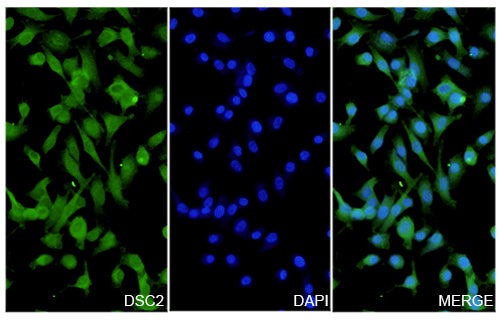 A549 cells were fixed with 4% paraformaldehyde for 20 minutes, followed by blocking with 5% goat serum for 1 hour. The cells were then incubated with a primary antibody targeting DSC2 (HX236014) at a concentration of 93.35 ug/ml overnight at 4°C. Afterward, the cells were incubated with a secondary antibody, Goat Anti-Rabbit IgG (Alexa Fluor-488) for 50 minutes at room temperature. The localization of DSC2 was visualized (shown in green), and nuclear DNA was stained with DAPI (shown in blue).