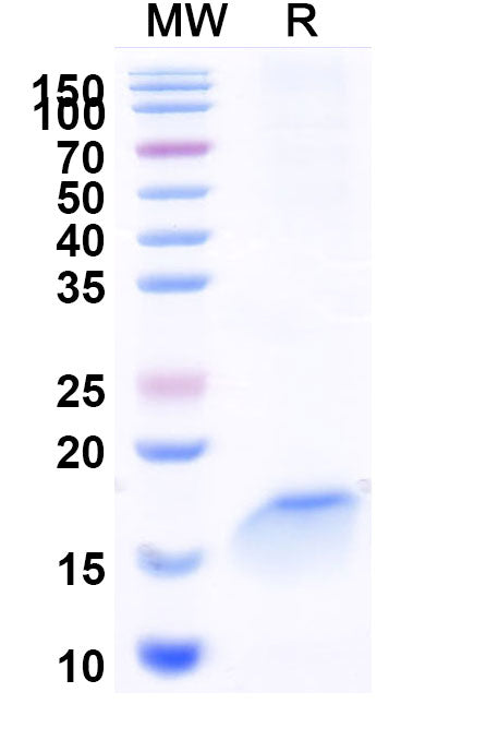 SDS-PAGE for Anti-Human B2M/Beta-2-microglobulin Nanobody (SAA1047).