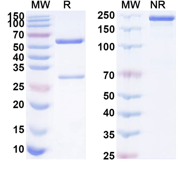 SDS-PAGE for Anti-Human B2M/β2-MG Antibody (1A051)