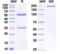 SDS-PAGE for Anti-Human B2M/β2-MG Antibody (1A052)