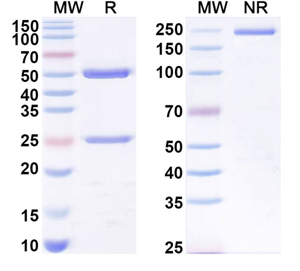 SDS-PAGE for Anti-Human B2M/β2-MG Antibody (1A052)