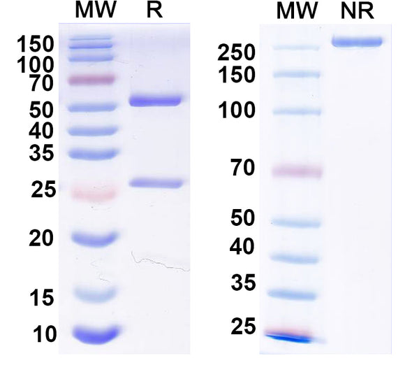 SDS-PAGE for Anti-Human B2M/β2-MG Antibody (1A053)