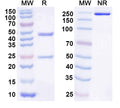 SDS-PAGE for Anti-Human B2M Monoclonal Antibody (1A063)