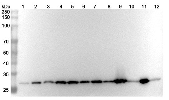 Western blot analysis was performed using anti-YWHAZ polyclonal antibody at 1ug/mL  on various samples.
Lane 1: SH-SY5Y cell lysate
Lane 2: Jurkat cell lysate
Lane 3: NIH3T3 cell lysate
Lane 4: Raji cell lysate
Lane 5: A549 cell lysate
Lane 6: K562 cell lysate
Lane 7: Hela cell lysate
Lane 8: PC-12 cell lysate
Lane 9: Mouse brain lysate
Lane 10: Mouse kidney lysate
Lane11: Rat brain lysate
Lane12: Rat kidney lysate