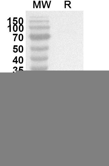 Western blot analysis was performed using anti-TGFB2 polyclonal antibody at 1ug/mL on recombinant TGFB2 (Catalog No. HX861012).