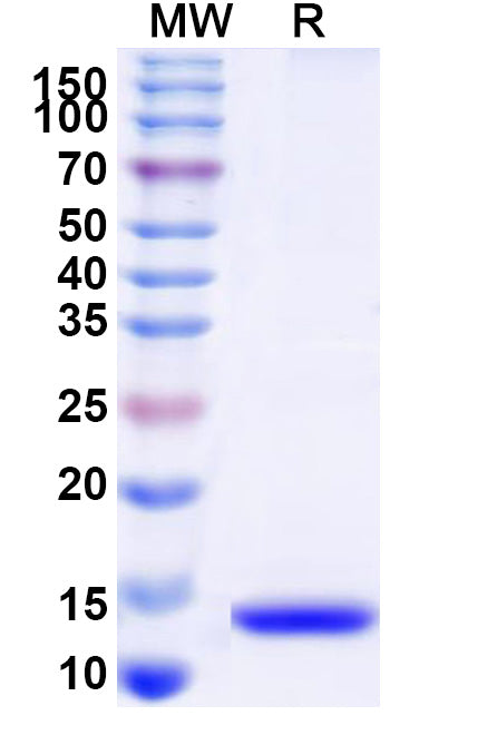 Recombinant Human COL10A1 Protein, N-His