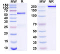 SDS-PAGE for Anti-Human LCN2/NGAL Monoclonal Antibody (1A391)