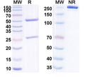 SDS-PAGE for Anti-Human LCN2/NGAL Monoclonal Antibody (1A392)