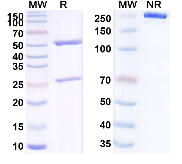 SDS-PAGE for Anti-Human LCN2/NGAL Monoclonal Antibody (1A392)
