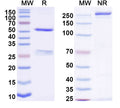 SDS-PAGE for Anti-Human Di-acetylated histone H4/H4K5acK8ac Antibody (1A9D7)