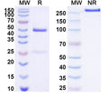 SDS-PAGE for Anti-Human CDH6 Antibody (SAA2000).