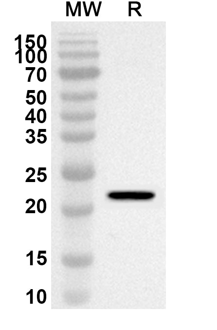 Western blot analysis was performed using anti-NKX6-1 polyclonal antibody at 1ug/mL on recombinant NKX6-1 (Catalog No. HX887022).