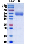 Recombinant Human CD172a/SIRPA Protein, C-His