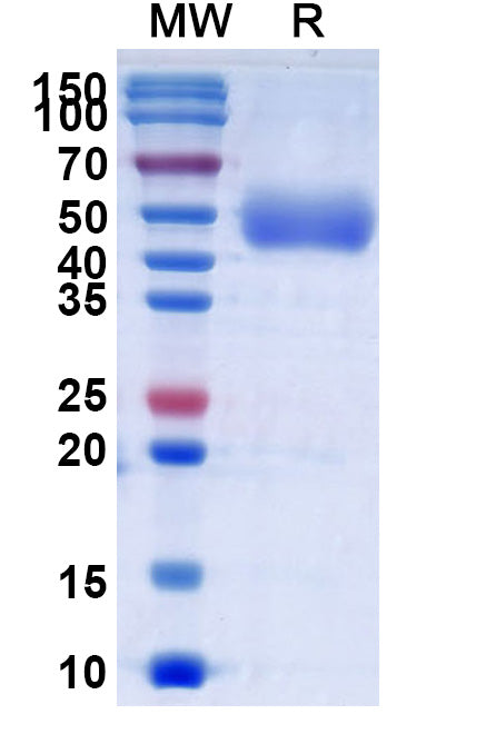 Recombinant Human CD172a/SIRPA Protein, C-His