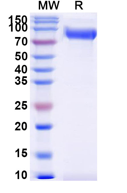 Recombinant Human CD172a/SIRPA Protein, C-Fc