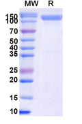 Recombinant Human CD202b/TEK Protein, C-His