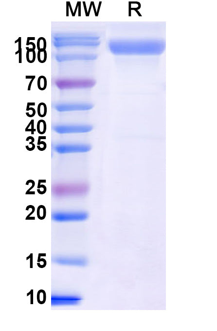 Recombinant Human CD202b/TEK Protein, C-His