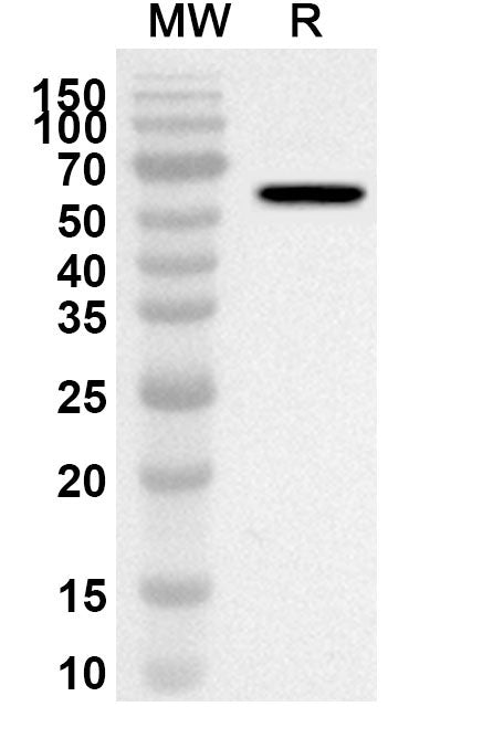 Western blot analysis was performed using anti-OXCT1 polyclonal antibody at 1ug/mL on recombinant OXCT1 (Catalog No. HX904012).