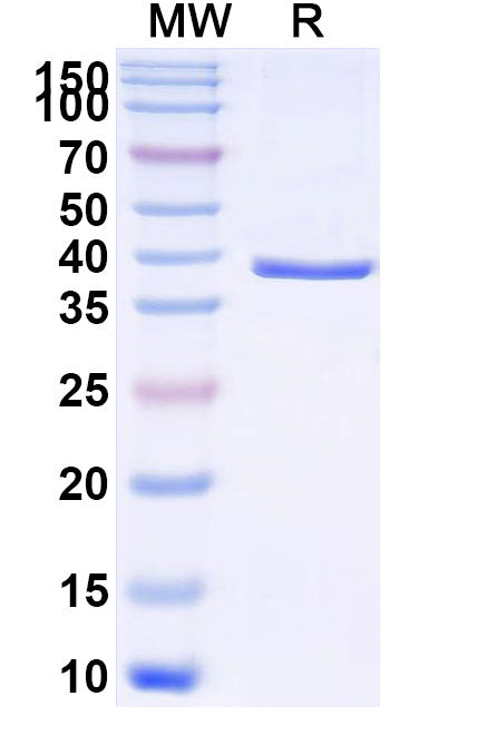 Recombinant Human CD213a1/IL13RA1 Protein, N-His