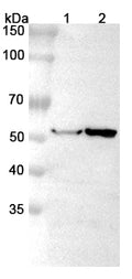 Western blot analysis was performed using anti-ABAT polyclonal antibody at 1μg/ml on various samples.
Lane 1: Rat liver lysate
Lane 2: Rat kindney lysate