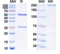 SDS-PAGE for Anti-Human TNFAIP6/TSG-6 Antibody (SAA1977)