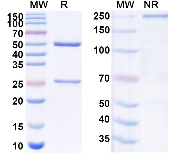 SDS-PAGE for Anti-Human TNFAIP6/TSG-6 Antibody (SAA1977)