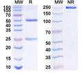 SDS-PAGE for Anti-SST Antibody (L111/118).
