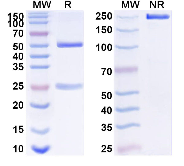 SDS-PAGE for Anti-SST Antibody (L111/118).