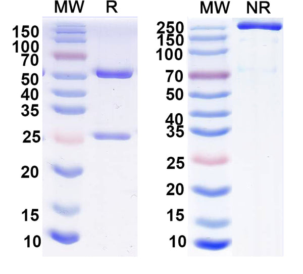 SDS-PAGE for Anti-SST Antibody (L111/140)