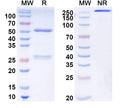 SDS-PAGE for Anti-SST Antibody (L111/43)