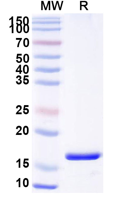 SDS-PAGE for Anti-Human PTH1R Nanobody (SAA0797)
