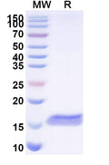 SDS-PAGE for Anti-Human PTH1R Nanobody (SAA1275)