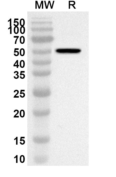 Western blot analysis was performed using anti-GNAS polyclonal antibody at 1ug/mL on recombinant GNAS (Catalog No. HX948012).